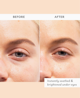Skin Remedy Eye Patches 5-pack